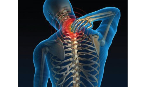 Ayurvedic tips to treat Cervical Spondylosis