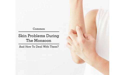 How to deal with Skin Problems in Monsoon? 